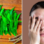 चेहरे की खूबसूरती के लिए नीम का ऐसे करें इस्तेमाल: दाग-धब्बे और पिंपल्स से राहत पाने में मिल सकती है मदद